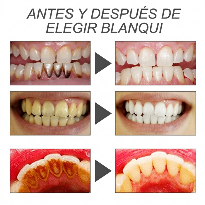 BLANQUI - Polvo Blanqueador Dental Premium